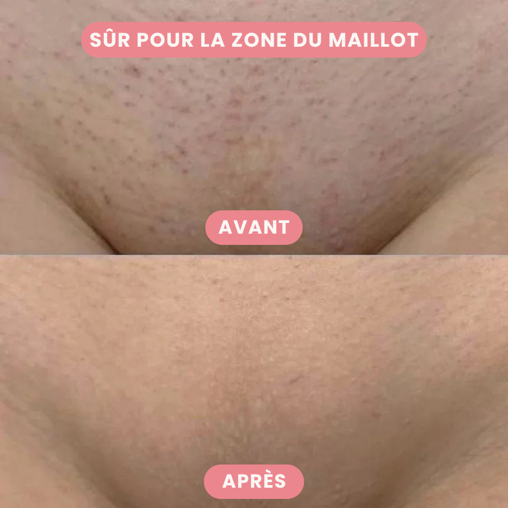 SilkTrim™ - Tondeuse 2-en-1 pour le Maillot et le Visage